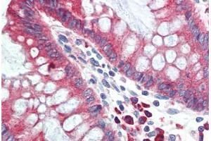 Human Colon (formalin-fixed, paraffin-embedded) stained with HYOU1 antibody ABIN396969 at 5 ug/ml followed by biotinylated goat anti-rabbit IgG secondary antibody ABIN481713, alkaline phosphatase-streptavidin and chromogen. (HYOU1 antibody  (C-Term))