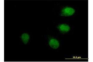 Immunofluorescence of purified MaxPab antibody to ANAPC10 on HeLa cell. (ANAPC10 antibody  (AA 1-185))