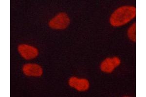 ABIN6267060 staining lovo cells by ICC/IF. (ERK1 antibody  (pThr202, pTyr204))