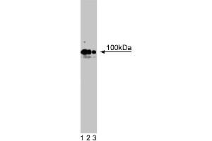 Western blot analysis of R-Cadherin on rat brain lysate. (Cadherin 4 antibody  (AA 22-201))