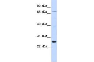 WB Suggested Anti-ZNF267 Antibody Titration:  0. (ZNF267 antibody  (Middle Region))