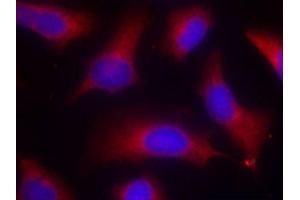 Immunofluorescence staining of methanol-fixed HeLa cells using Phospho-MAPT-S262 antibody (ABIN2988151).