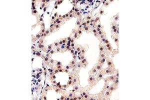 Immunohistochemical analysis of paraffin-embedded H. (CSNK2A1/CK II alpha antibody  (AA 250-284))