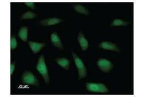 Immunostaining analysis in HeLa cells. (KDM4A antibody)