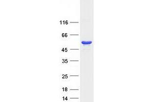 Validation with Western Blot (PRKAR1A Protein (Transcript Variant 1) (Myc-DYKDDDDK Tag))