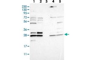 Western blot analysis of Lane 1: RT-4, Lane 2: U-251 MG, Lane 3: Human Plasma, Lane 4: Liver, Lane 5: Tonsil with CNPY4 polyclonal antibody . (CNPY4 antibody)
