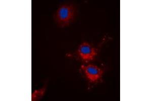 Immunofluorescent analysis of BCLX (pS62) staining in HEK293T cells. (BCL2L1 antibody  (pSer62))