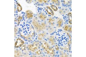 Immunohistochemistry of paraffin-embedded mouse kidney using STX7 antibody (ABIN6128800, ABIN6148669, ABIN6148670 and ABIN6224079) at dilution of 1:100 (40x lens). (Syntaxin 7 antibody  (AA 1-170))