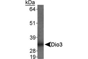 Detection of Dio3 in rat placenta using Dio3 polyclonal antibody . (DIO3 antibody  (AA 250-300))