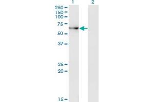 Western Blot analysis of ACD expression in transfected 293T cell line by ACD monoclonal antibody (M01A), clone 1C11-1A7. (ACD antibody  (AA 1-544))