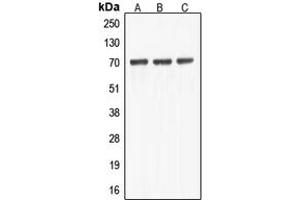 Western blot analysis of ABCF2 expression in HEK293T (A), HeLa (B), NIH3T3 (C) whole cell lysates. (ABCF2 antibody  (Center))