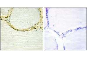 Immunohistochemistry analysis of paraffin-embedded human thyroid gland, using ETK (Phospho-Tyr566) Antibody. (BMX antibody  (pTyr566))