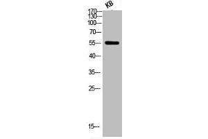 Western Blot analysis of KB using Phospho-Akt (S473) Polyclonal Antibody (AKT 1/2/3 antibody  (pSer473))