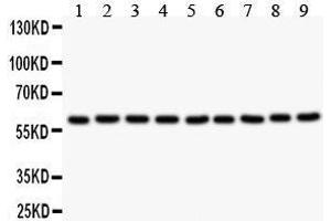 Anti- SMAD4 Picoband antibody, Western blotting All lanes: Anti SMAD4  at 0. (SMAD4 antibody  (C-Term))