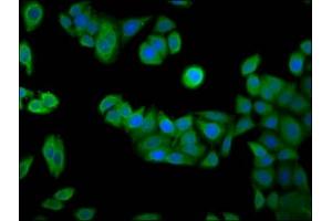 Immunofluorescence staining of PC-3 cells with ABIN7167258 at 1:133, counter-stained with DAPI. (RAB24 antibody  (AA 122-197))