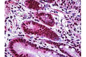Immunohistochemistry (IHC) image for anti-X-Ray Repair Complementing Defective Repair in Chinese Hamster Cells 6 (XRCC6) (AA 1-610) antibody (ABIN626028)