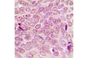 Immunohistochemistry (IHC) image for anti-Small Ubiquitin Related Modifier Protein 1 (SUMO1) (N-Term) antibody (ABIN7297228)