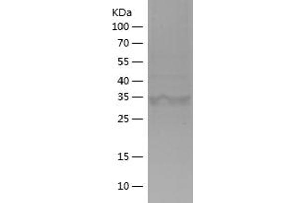 IDH1 Protein (AA 341-414) (His-IF2DI Tag)