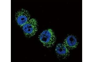 Confocal immunofluorescent analysis of DBH antibody with A2058 cells followed by Alexa Fluor 488-conjugated goat anti-rabbit lgG (green). (DBH antibody  (AA 27-56))