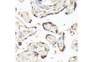 Immunohistochemistry of paraffin-embedded human placenta using KLF5 antibody (ABIN3023447, ABIN3023448, ABIN3023449 and ABIN6219969) at dilution of 1:100 (40x lens). (KLF5 antibody  (AA 1-250))