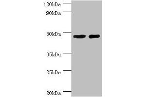 Western blot All lanes: SMAD3 antibody at 8 μg/mL Lane 1: Jurkat whole cell lysate Lane 2: A431 whole cell lysate Secondary Goat polyclonal to rabbit IgG at 1/10000 dilution Predicted band size: 49, 44, 36, 26 kDa Observed band size: 49 kDa (SMAD3 antibody  (AA 1-230))