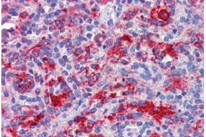 Spleen, Human: Formalin-Fixed, Paraffin-Embedded (FFPE) (DDX58 antibody)