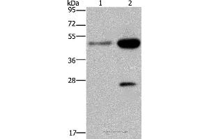 Western blot analysis of 231 and Hela cell, using CD160 Polyclonal Antibody at dilution of 1:300 (CD160 antibody)