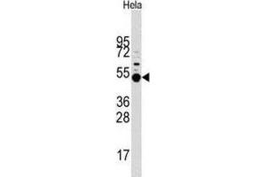 Western Blotting (WB) image for anti-Mitogen-Activated Protein Kinase-Activated Protein Kinase 5 (MAPKAPK5) antibody (ABIN3003051) (MAPKAP Kinase 5 antibody)