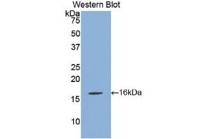 WB of Protein Standard: different control antibodies against Highly purified E. (Klotho beta ELISA Kit)