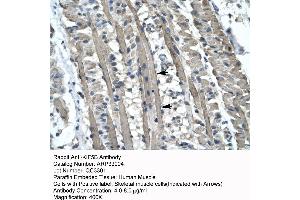 Human Muscle (KIF5B antibody  (C-Term))