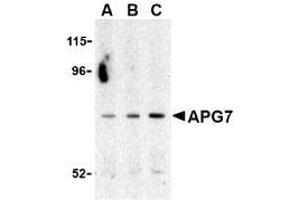 Western blot analysis of ATG7 in Caco-2 cell lysate with ATG7 Antibody at (A) 0. (ATG7 antibody  (C-Term))