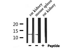 Western blot analysis of extracts from rat kidney and mouse spleen, using IGFL2 Antibody. (IGFL2 antibody)