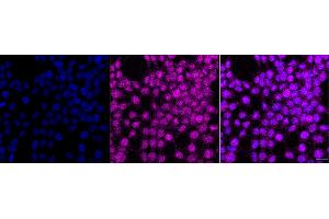 anti-General Transcription Factor IIB (GTF2B) antibody