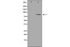 Western blot analysis of B-RAF phosphorylation expression in whole cell lysates,The lane on the left is treated with the antigen-specific peptide. (BRAF antibody  (pThr599))