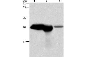 Western Blot analysis of Mouse brain and kidney tissue, Human fetal brain tissue using CALB1 Polyclonal Antibody at dilution of 1:750 (CALB1 antibody)