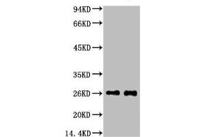 Western blot analysis of 1) Mouse spleen tissue, 2) Rat spleen tissue, diluted at 1:3000. (EFHD1 antibody)