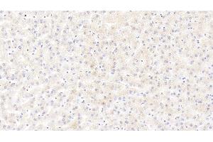 Detection of CALM1 in Human Liver Tissue using Polyclonal Antibody to Calmodulin 1 (CALM1) (Calmodulin 1 antibody  (AA 1-149))