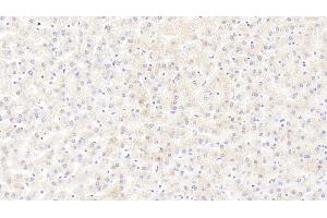 Detection of CALM1 in Human Liver Tissue using Polyclonal Antibody to Calmodulin 1 (CALM1) (Calmodulin 1 antibody  (AA 1-149))