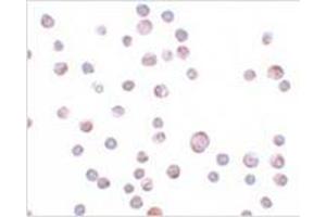 Immunocytochemistry of ZC3HAV1 in HeLa cells with ZC3HAV1 antibody at 20 μg/ml. (ZC3HAV1 antibody  (C-Term))