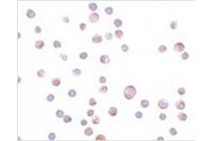 Immunocytochemistry of ZC3HAV1 in HeLa cells with ZC3HAV1 antibody at 20 μg/ml.