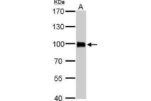 WB Image Villin antibody detects VIL1 protein by Western blot analysis. (Villin 1 antibody  (N-Term))