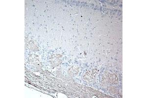 IHC on rat olfactory using Rabbit antibody to rat & mouse OMP (Olfactory Marker Protein): IgG  at a concentration of 20 µg/ml in paraffin embeded section.