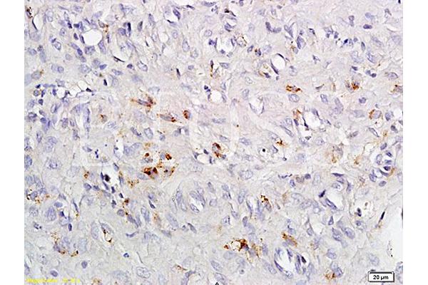 CCR4 antibody  (AA 201-300)