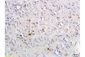 Formalin-fixed and paraffin embedded rat exfoliated cells tissue labeled with Anti-CCR4 Polyclonal Antibody, Unconjugated (ABIN738666) at 1:200 followed by conjugation to the secondary antibody and DAB staining (CCR4 antibody  (AA 201-300))
