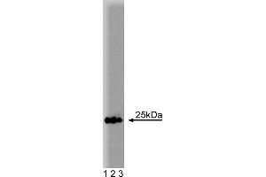 Western Blotting (WB) image for anti-RAB5A, Member RAS Oncogene Family (RAB5A) (AA 1-215) antibody (ABIN968139) (RAB5 antibody  (AA 1-215))