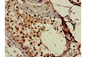 Immunohistochemistry of paraffin-embedded human testis tissue using ABIN7171024 at dilution of 1:100 (SMN1 antibody  (AA 3-194))