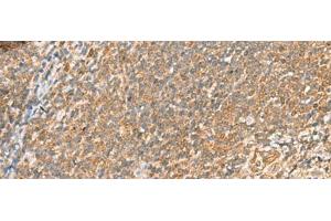 Immunohistochemistry of paraffin-embedded Human tonsil tissue using SCRN2 Polyclonal Antibody at dilution of 1:60(x200) (SCRN2 antibody)
