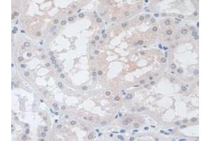 IHC-P analysis of Human Kidney Tissue, with DAB staining. (VCP antibody  (AA 125-371))