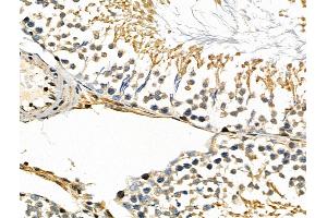 ABIN6257420 and ABIN6275854 at 1/100 staining Rat testis tissue by IHC-P.