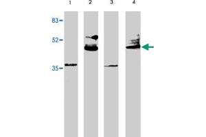 Western blot analysis using VSX2 polyclonal antibody at 1 ug/mL on rat liver (lane 1), retina tissue lysate (lane 2), mouse liver (lane 3) and retina (lane 4) tissue lysate.